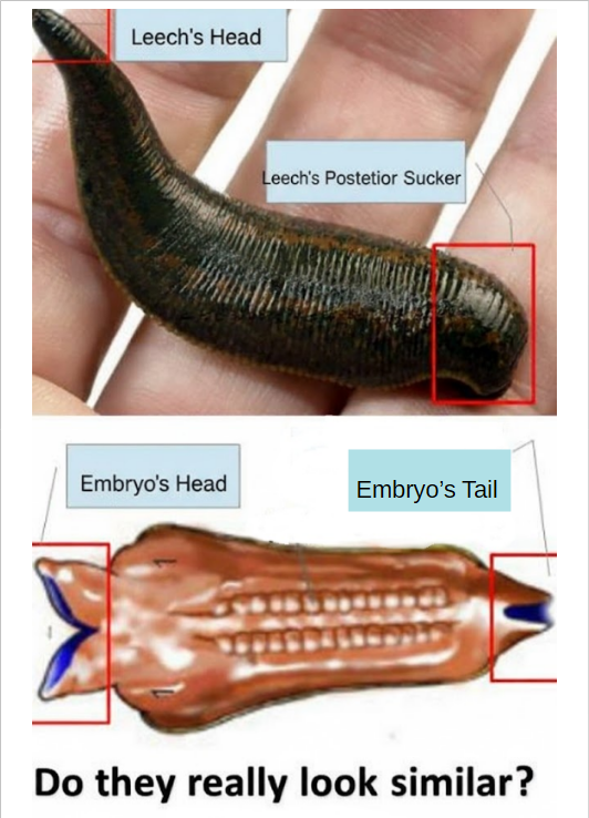 Leech vs. Embryo [Islamists Deception]