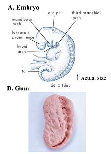 Mughdah Stage of Islamic Embryology